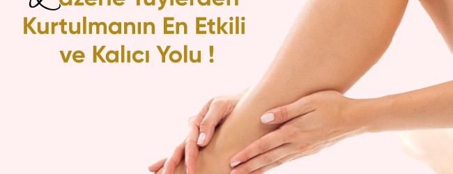 Lazer Epilasyondan Sonra Kıl Tekrar Çıkar mı ?